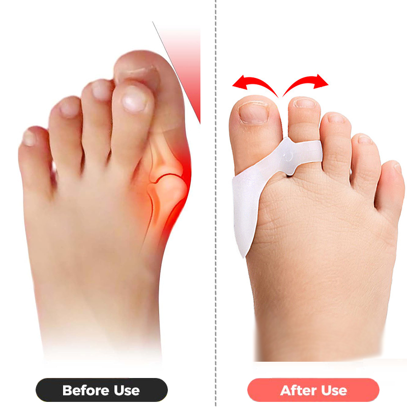 Pexmen 2/4Pcs Toe Spacers Buni - đánh giá và giá Power Tools Kids